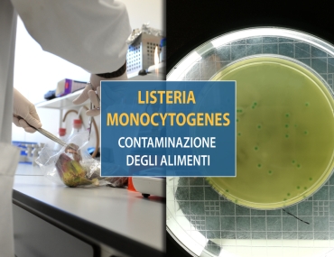 Contaminazione degli alimenti da Listeria Monocytogenes: strategie di minimizzazione del rischio